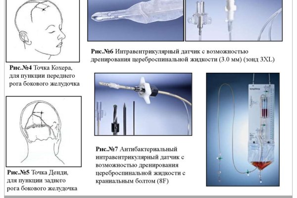 Ссылки на сайты даркнета